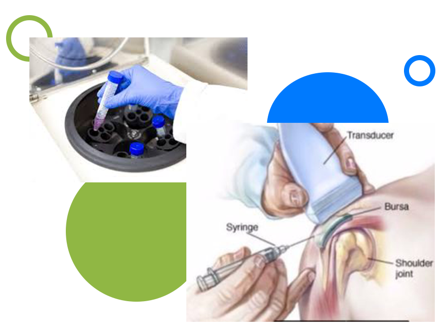Stem Cell/PRP