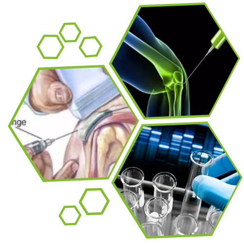 Stem Cell/PRP